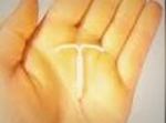 Mirena-IUD-Uterus-Perforation-attorney-001.jpg