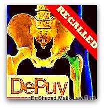 dallas_depuy_hip_recall_attorney.jpg