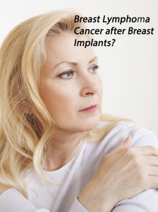 Breast implants linked to cancer