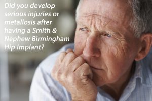 Birmingham Hip Implant Resurfacing Lawsuit News